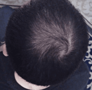 Загуститель волос Caboke для мужчин (Узбекистан)